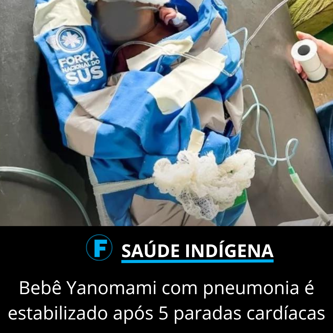 Bebê Yanomami com pneumonia é estabilizado após 5 paradas cardíacas