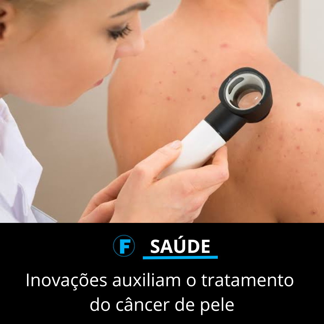 Inovações auxiliam o tratamento do câncer de pele