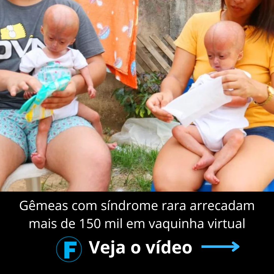 Gêmeas com síndrome rara arrecadam mais de 150 mil em vaquinha virtual