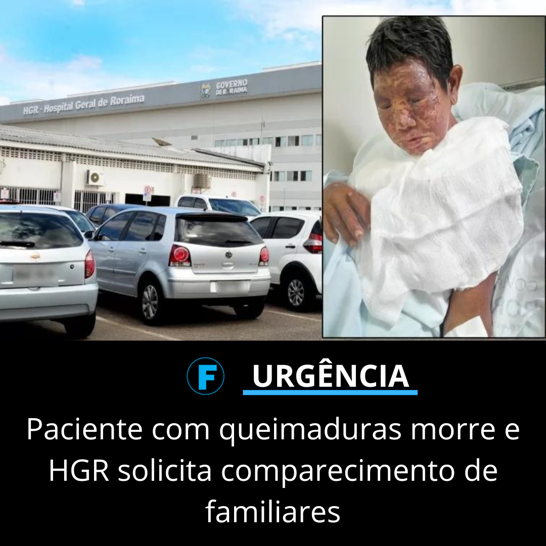 Paciente com queimaduras morre e HGR solicita comparecimento de familiares