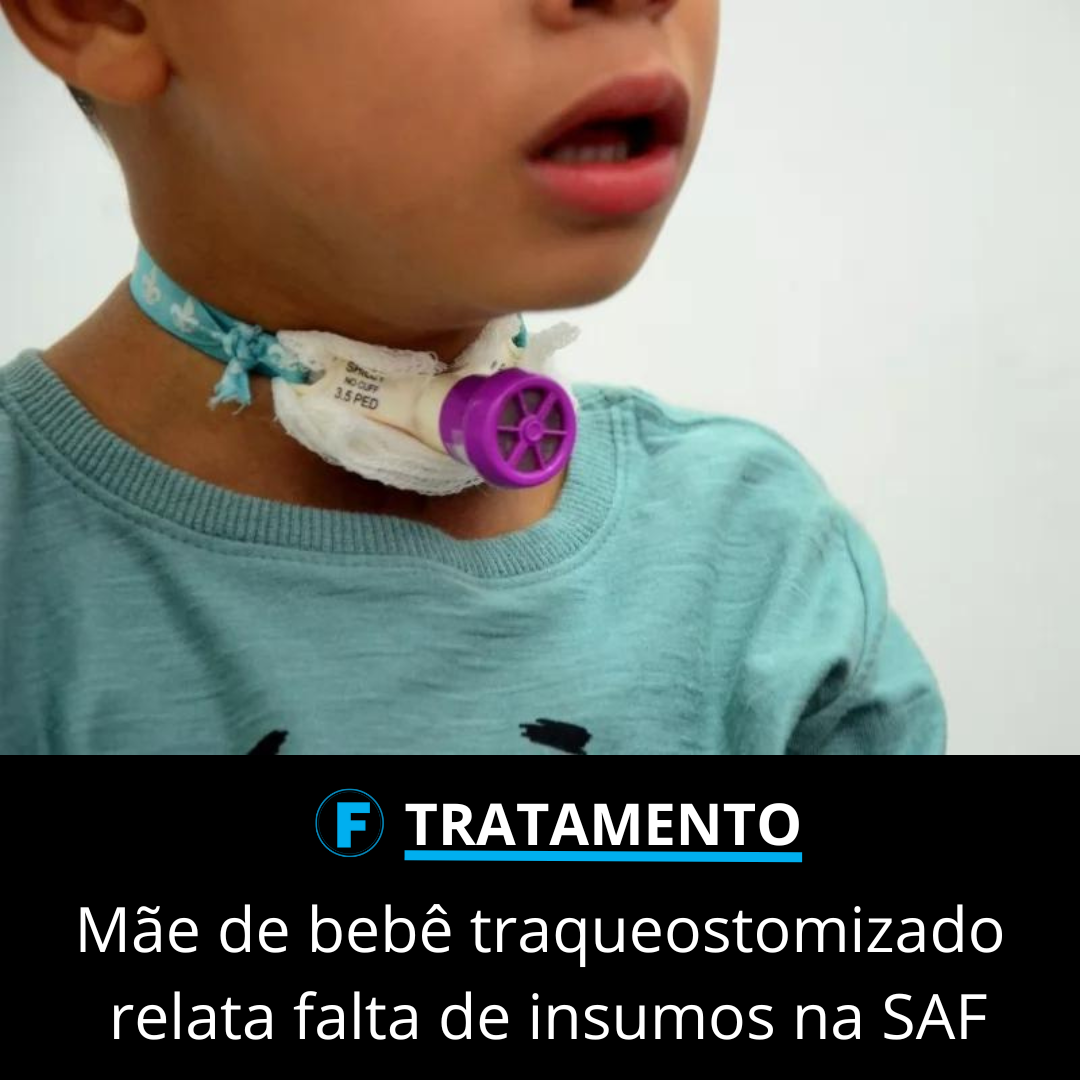 Mãe de bebê traqueostomizado relata falta de insumos na SAF