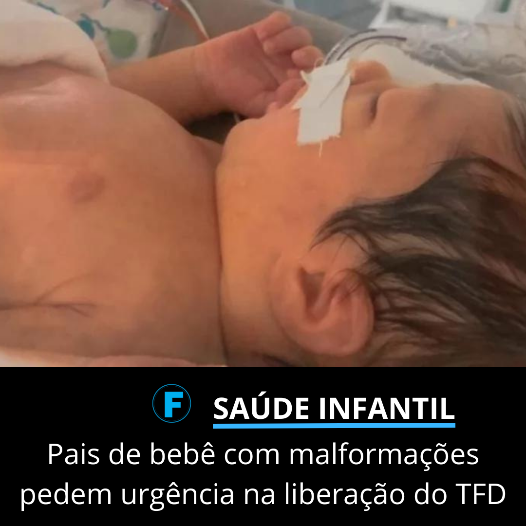 Pais de bebê com malformações pedem urgência na liberação do TFD