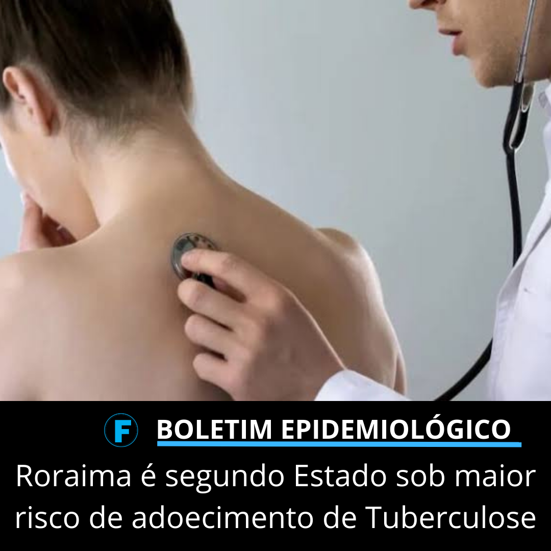 Roraima é segundo Estado sob maior risco de adoecimento de Tuberculose