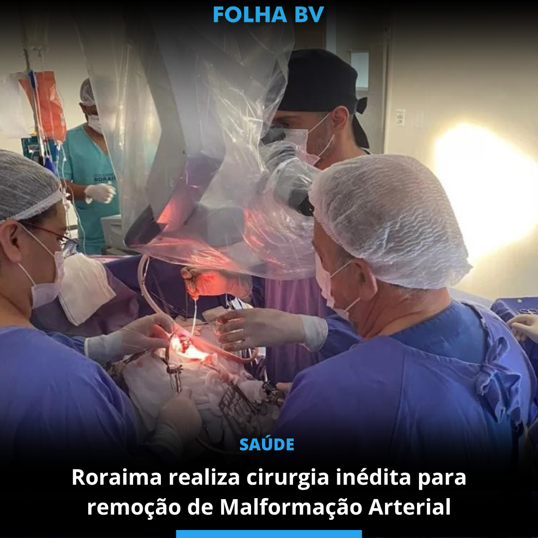Roraima realiza cirurgia inédita para remoção de Malformação Arterial