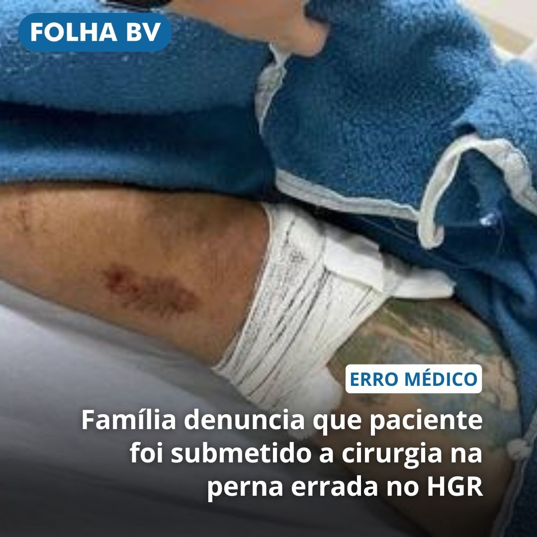 https://www.folhabv.com.br/cotidiano/familia-acusa-hgr-de-realizar-cirurgia-em-perna-errada-de-paciente/