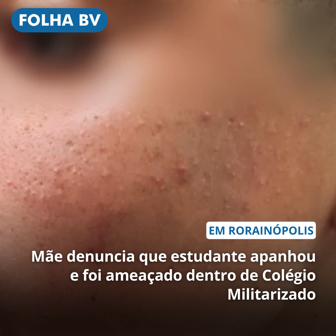 Mãe denuncia que estudante apanhou e foi ameaçado dentro de Colégio Militarizado