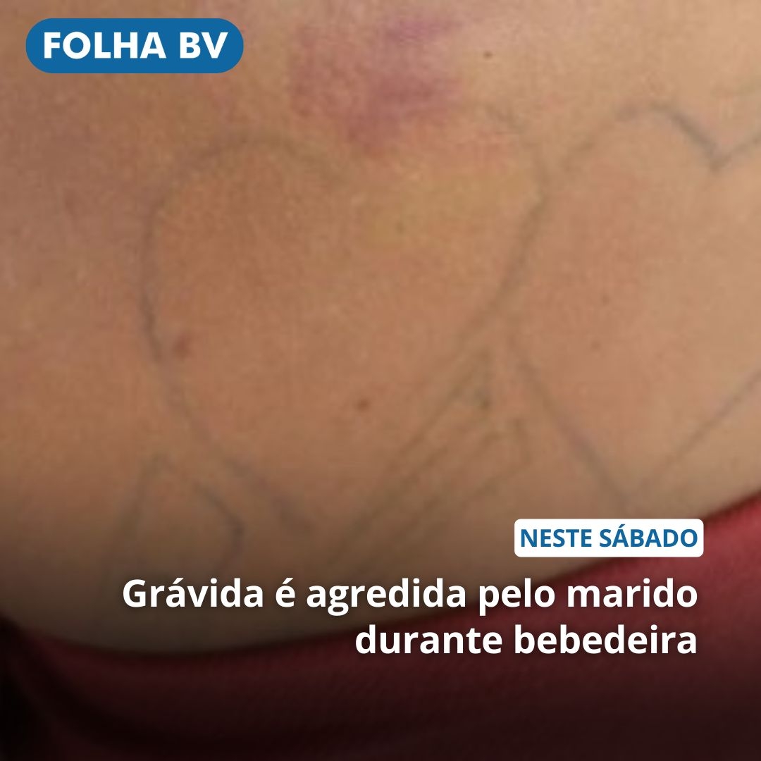https://www.folhabv.com.br/policia/gravida-e-agredida-pelo-marido-durante-bebedeira/