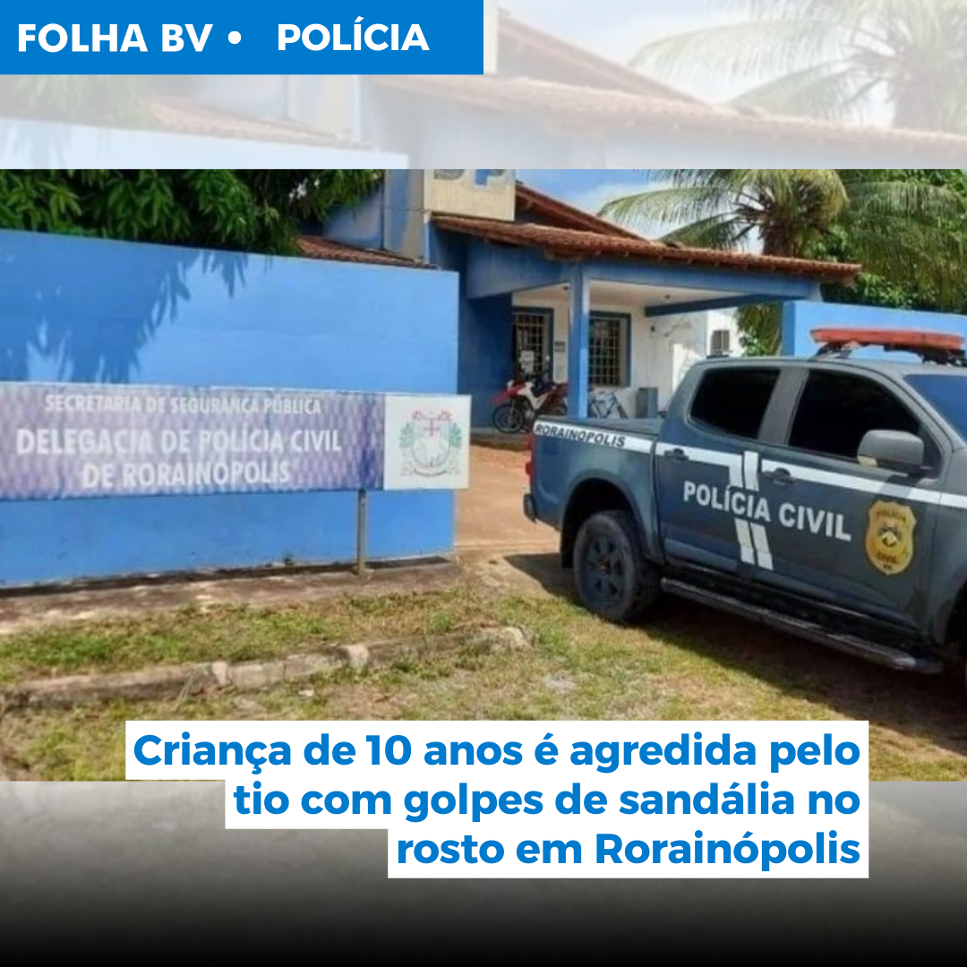 Criança de 10 anos é agredida pelo tio com golpes de sandália no rosto em Rorainópolis