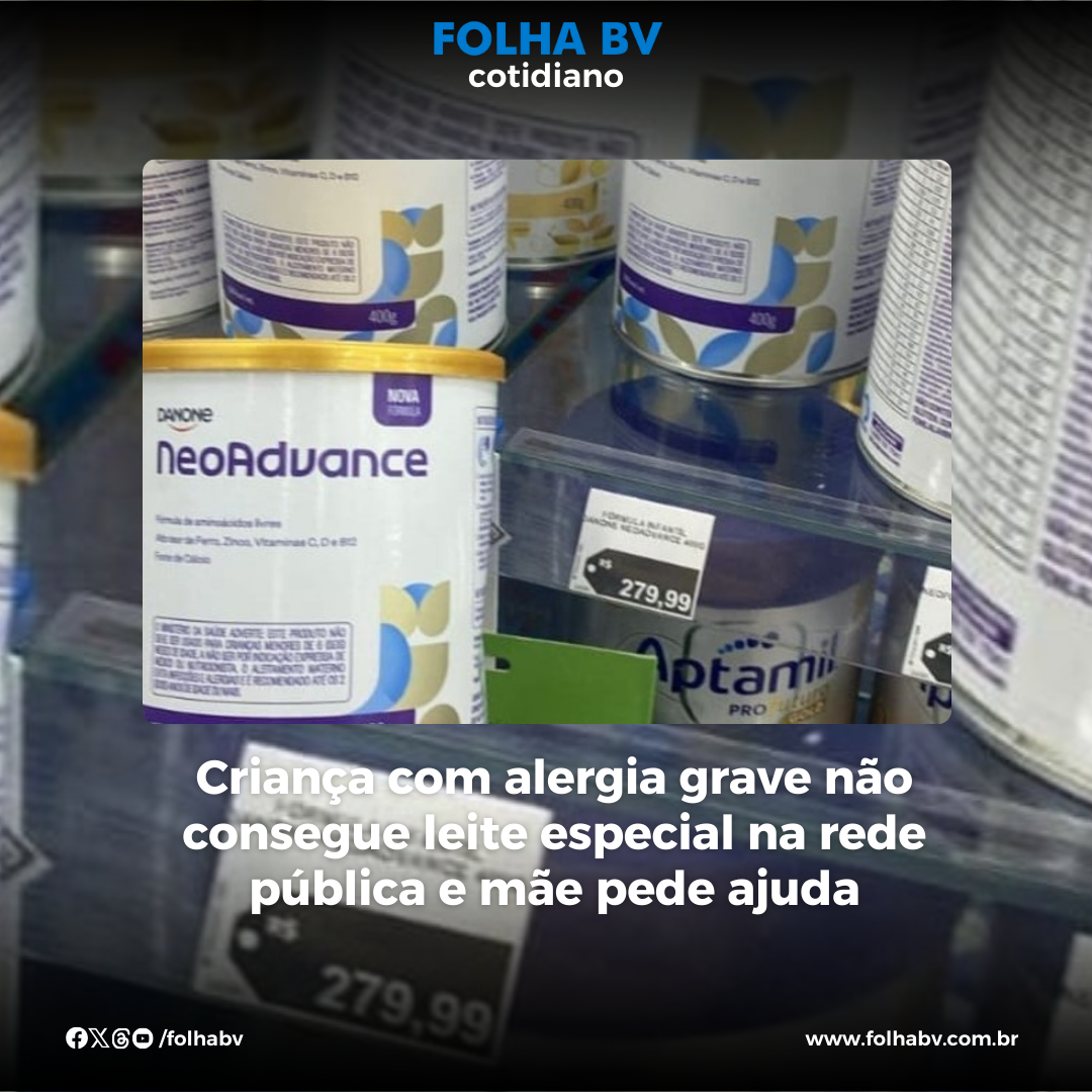 https://www.folhabv.com.br/cotidiano/mae-faz-campanha-para-custear-lata-de-leite-de-r280-para-filha-alergica-de-dois-anos/