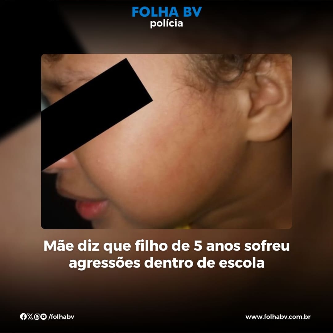 https://www.folhabv.com.br/educacao/mae-diz-que-filho-de-5-anos-sofreu-agressoes-dentro-de-escola/