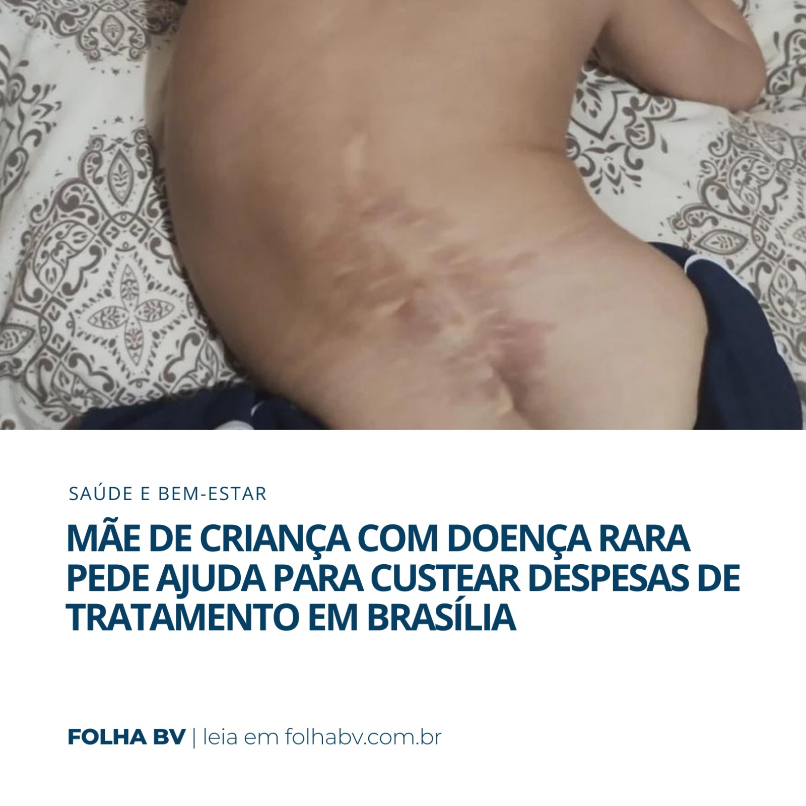 https://www.folhabv.com.br/saude-e-bem-estar/mae-de-crianca-com-doenca-rara-pede-ajuda-para-custear-despesas-de-tratamento-em-brasilia/