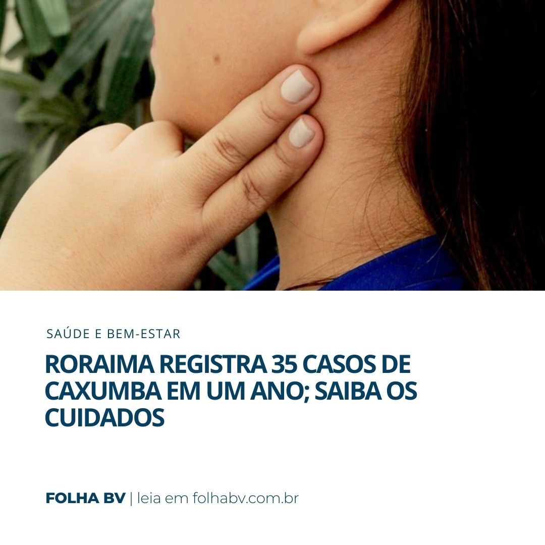 https://www.folhabv.com.br/saude-e-bem-estar/roraima-registra-35-casos-de-caxumba-em-um-ano-saiba-os-cuidados/
