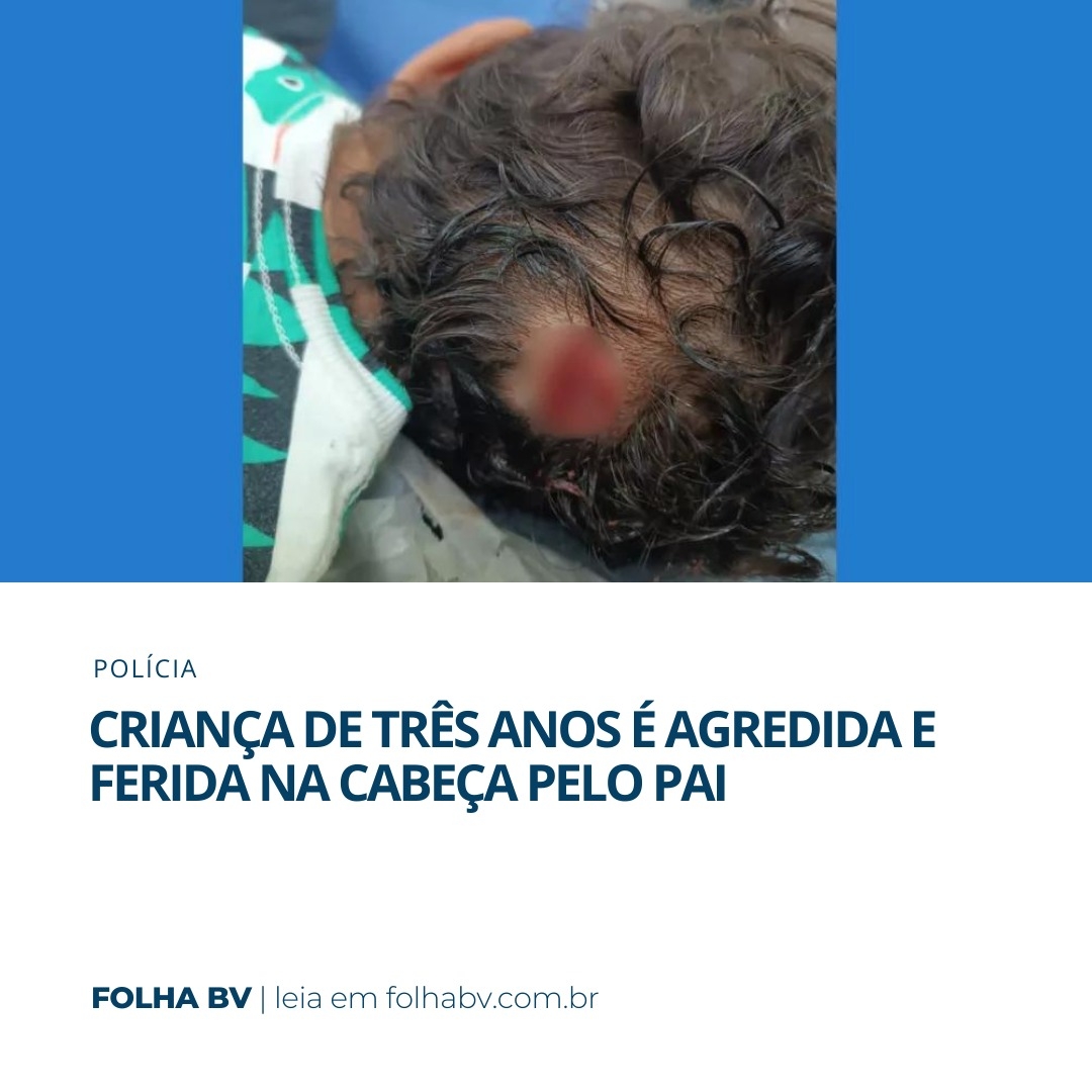 https://www.folhabv.com.br/policia/crianca-de-tres-anos-e-agredida-e-ferida-na-cabeca-pelo-pai/