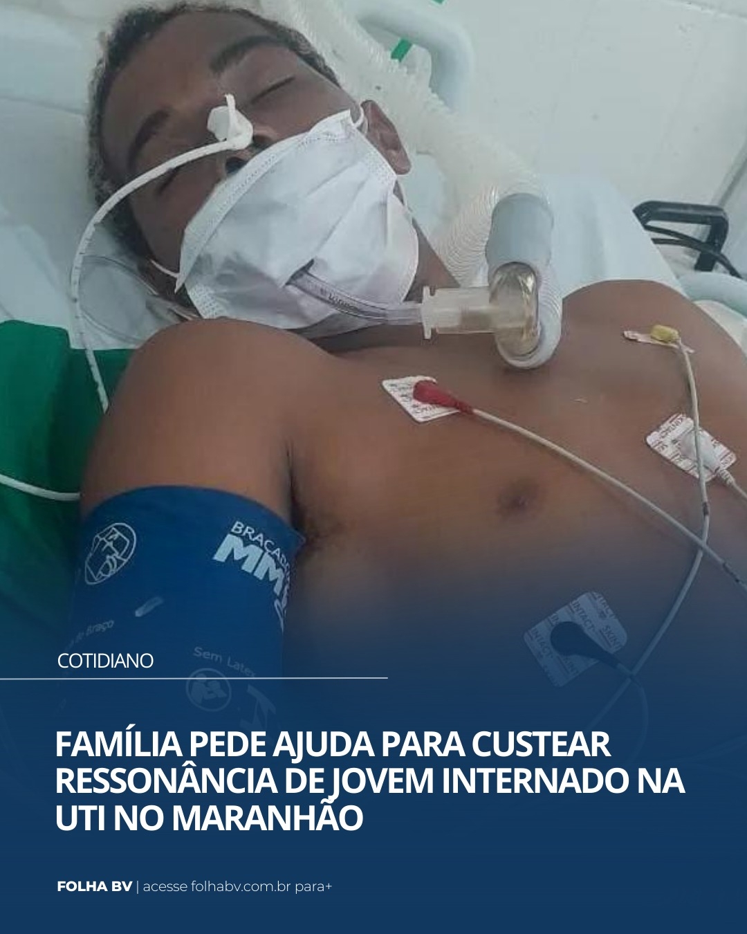 https://www.folhabv.com.br/cotidiano/familia-pede-ajuda-para-custear-ressonancia-de-jovem-internado-na-uti-no-maranhao/