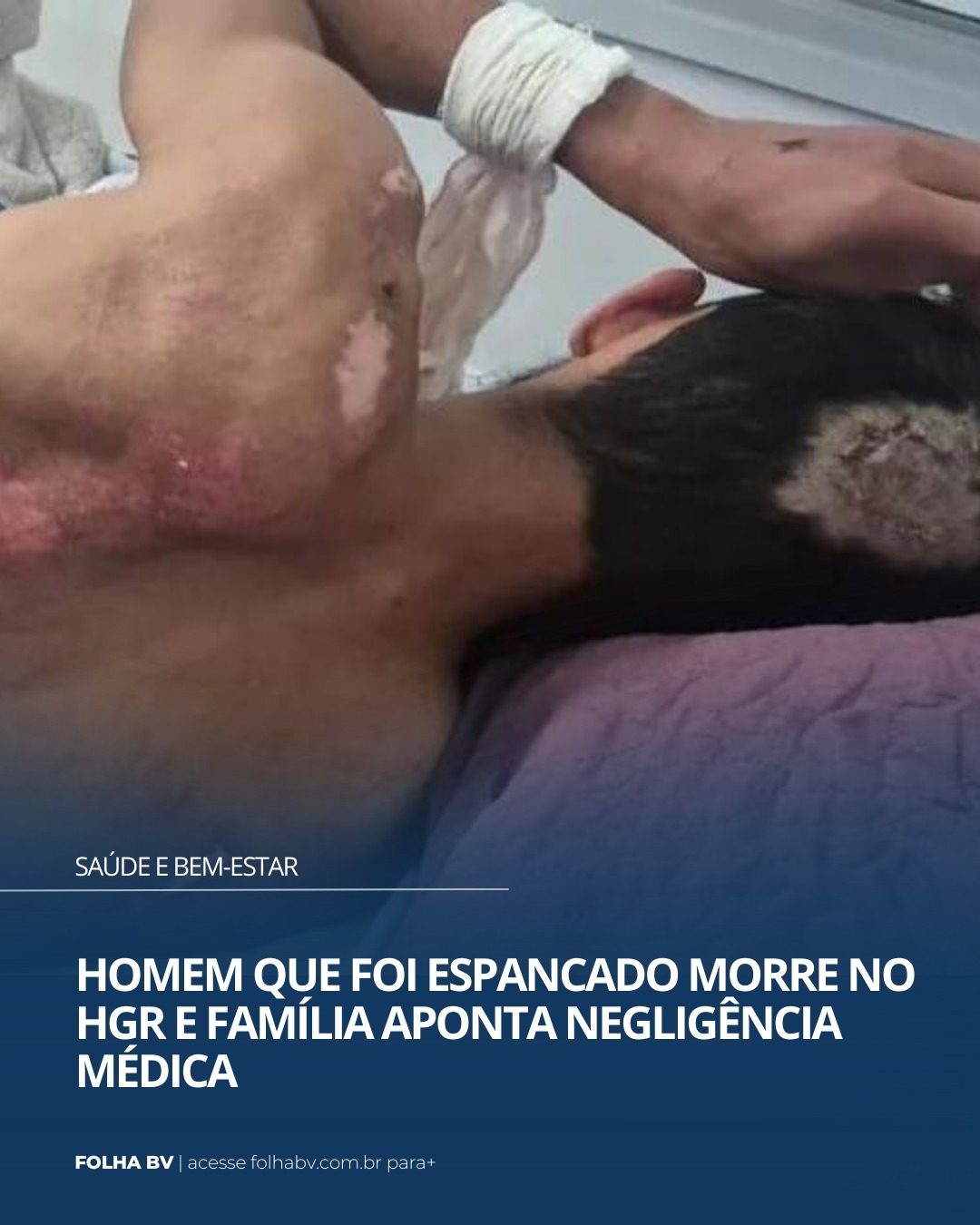 https://www.folhabv.com.br/saude-e-bem-estar/homem-que-foi-espancado-morre-no-hgr-e-familia-aponta-negligencia-medica/