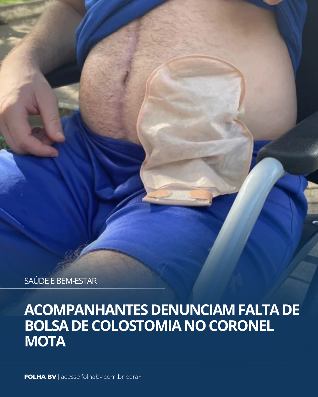 https://www.folhabv.com.br/saude-e-bem-estar/acompanhantes-denunciam-falta-de-bolsa-de-colostomia-no-coronel-mota/