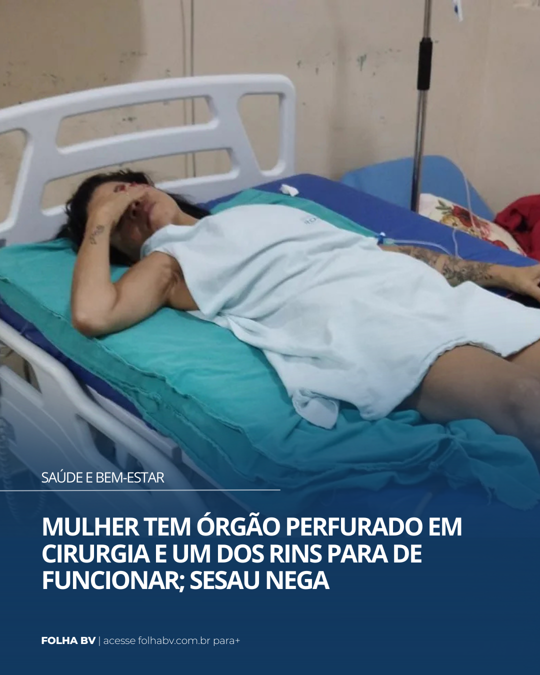 https://www.folhabv.com.br/saude-e-bem-estar/mulher-tem-orgao-perfurado-em-cirurgia-e-um-dos-rins-para-de-funcionar-sesau-nega/
