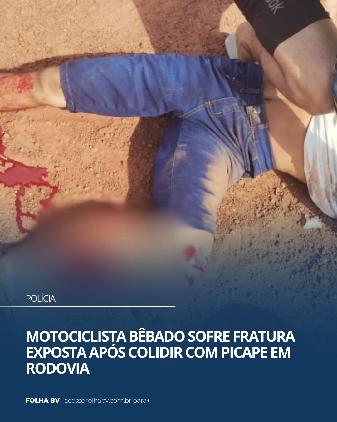 https://www.folhabv.com.br/policia/motociclista-bebado-sofre-fratura-exposta-apos-colidir-com-picape-em-rodovia/
