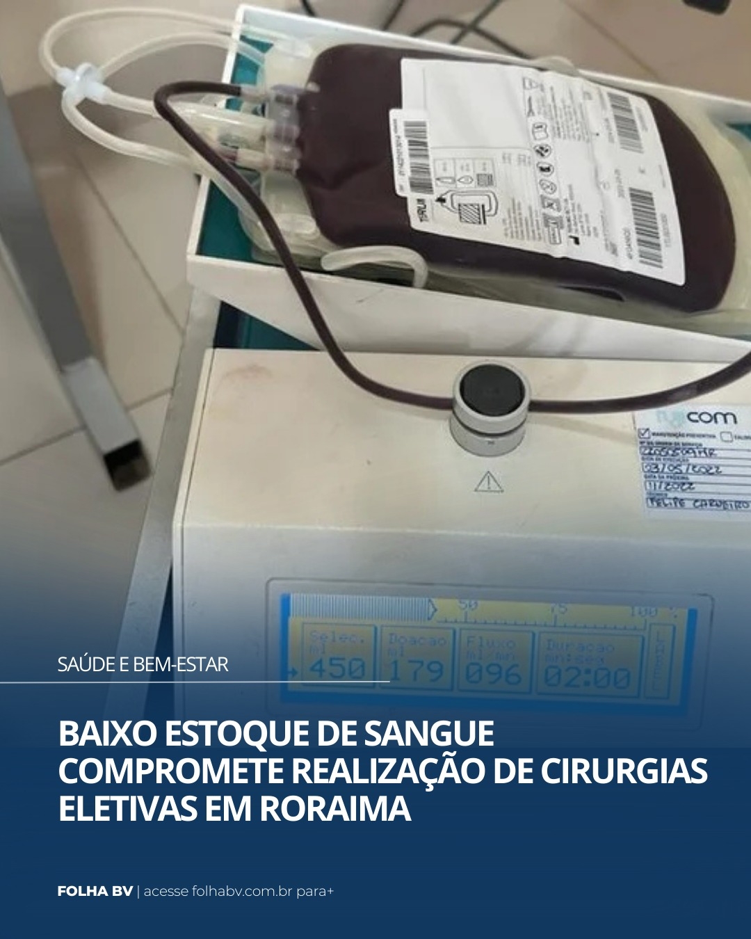 https://www.folhabv.com.br/saude-e-bem-estar/baixo-estoque-de-sangue-compromete-realizacao-de-cirurgias-eletivas-em-roraima/