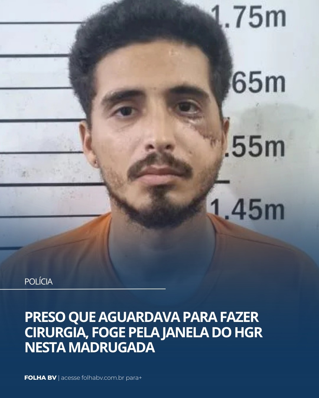 https://www.folhabv.com.br/policia/preso-que-aguardava-para-fazer-cirurgia-foge-pela-janela-do-hgr-nesta-madrugada/