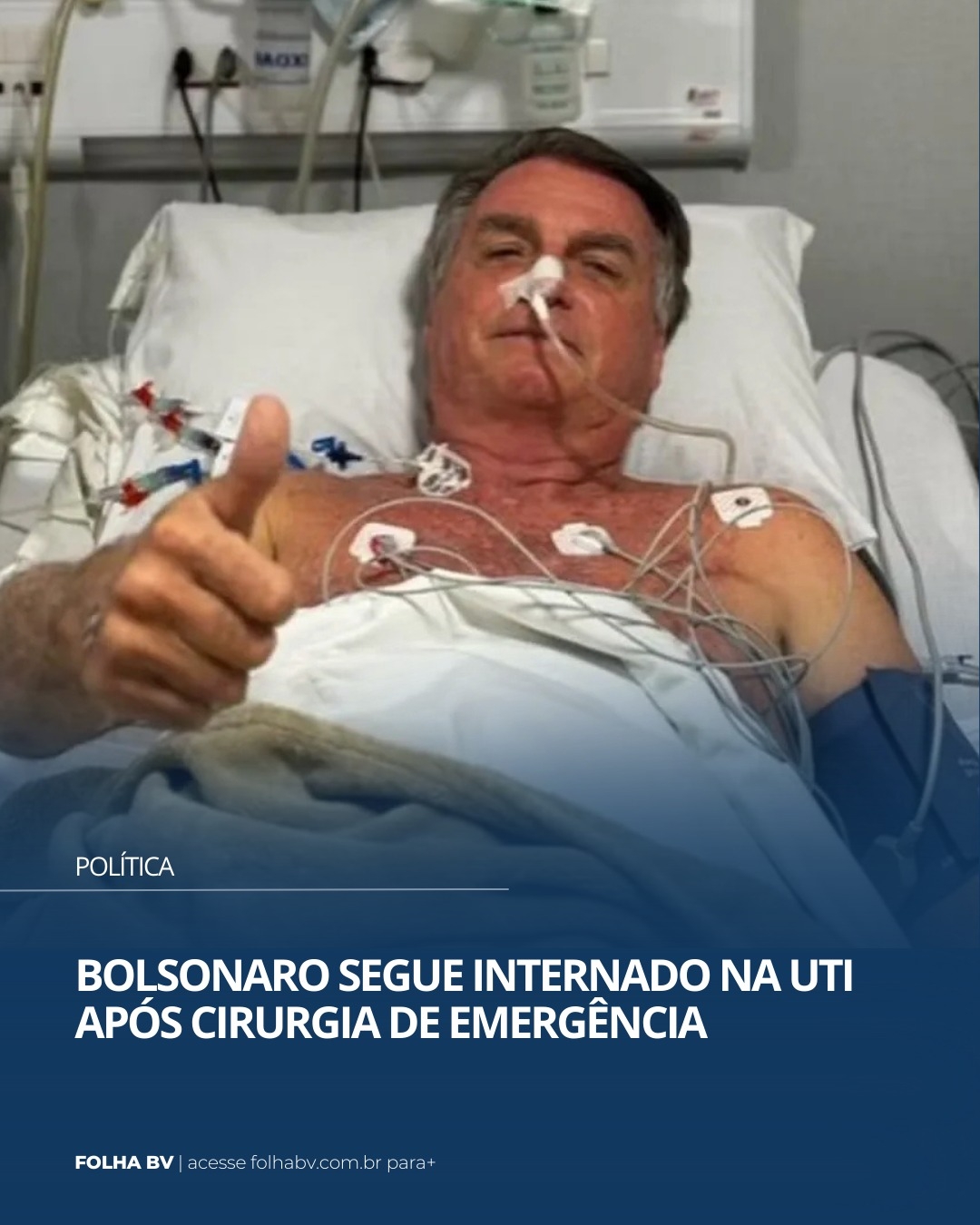 https://www.folhabv.com.br/politica/bolsonaro-segue-internado-na-uti-apos-cirurgia-de-emergencia/