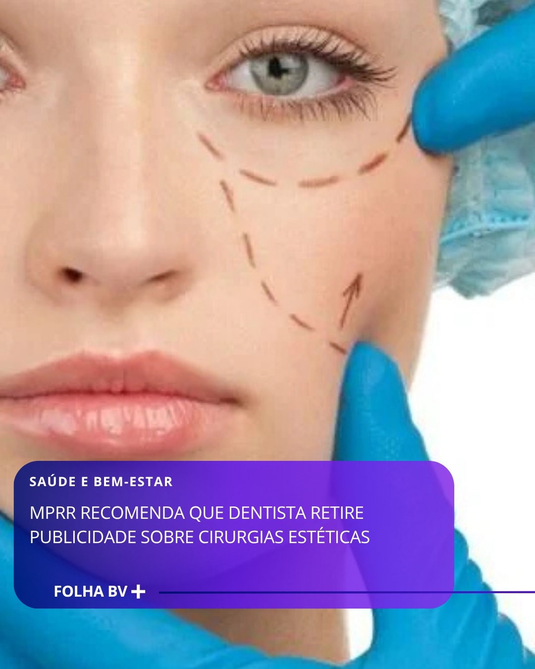 https://www.folhabv.com.br/saude-e-bem-estar/mprr-recomenda-que-dentista-retire-publicidade-sobre-cirurgias-esteticas/