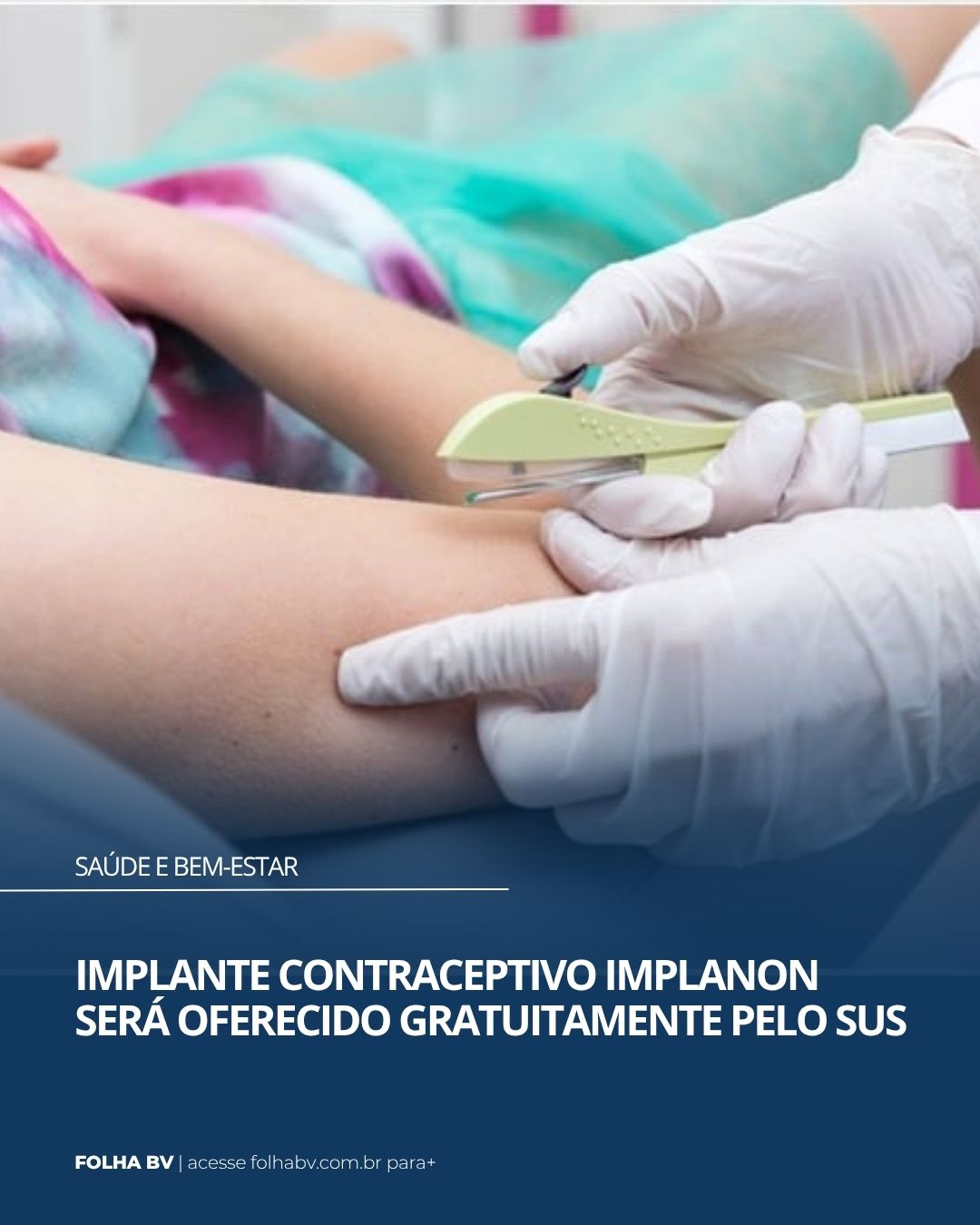 https://www.folhabv.com.br/saude-e-bem-estar/implante-contraceptivo-implanon-sera-oferecido-gratuitamente-pelo-sus/