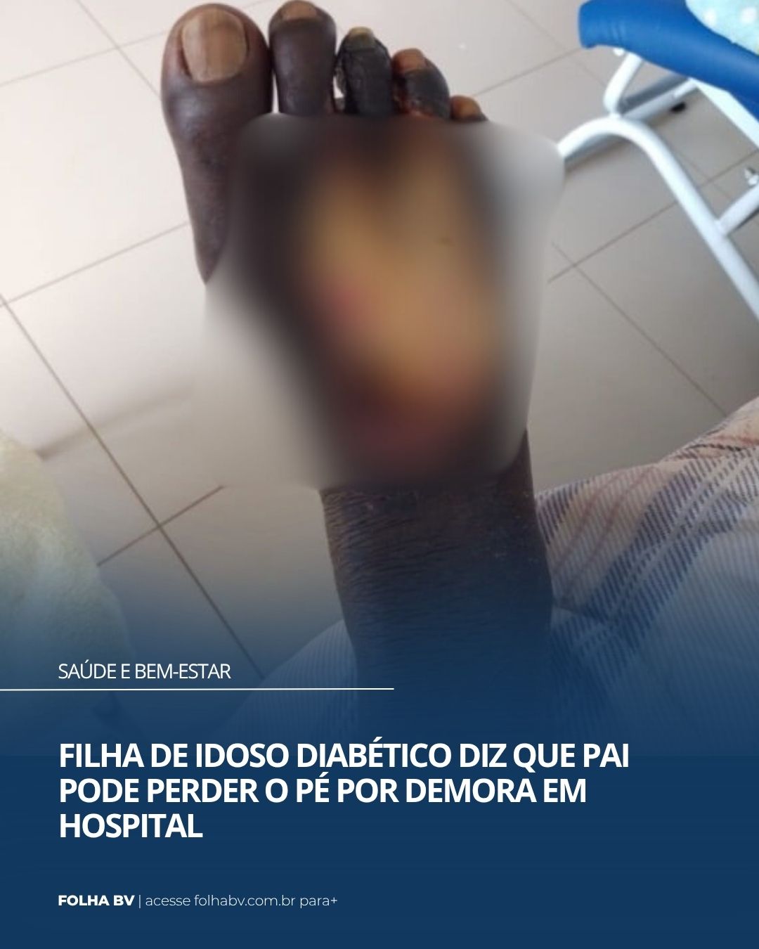 https://www.folhabv.com.br/cotidiano/filha-de-idoso-diabetico-diz-que-pai-pode-perder-o-pe-por-demora-em-hospital/